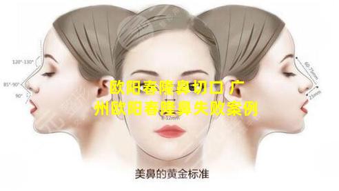 欧阳春隆鼻切口 广州欧阳春隆鼻失败案例